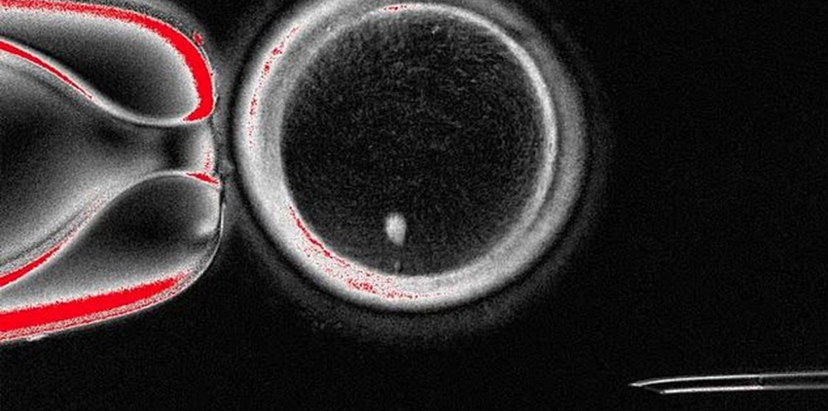 Foshnjat mund të lindin pa nënën biologjike?! Shkencëtarët krijojnë vezore njerëzore nga qelizat e lëkurës 
