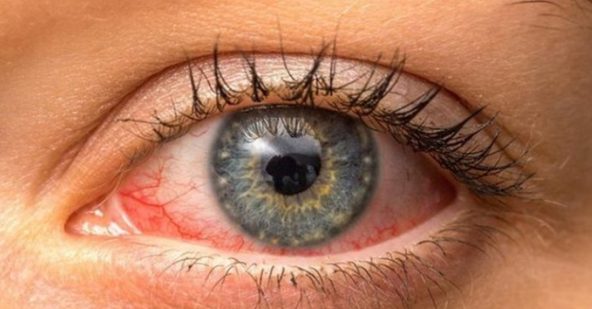 Tharja e syve nga telefoni, kujdesi që duhet të tregoni 