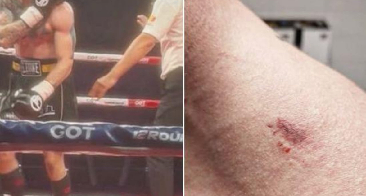 Boksieri shqiptar fiton me nokaut teknik, kundërshtari serb qahet: Më kafshoi…