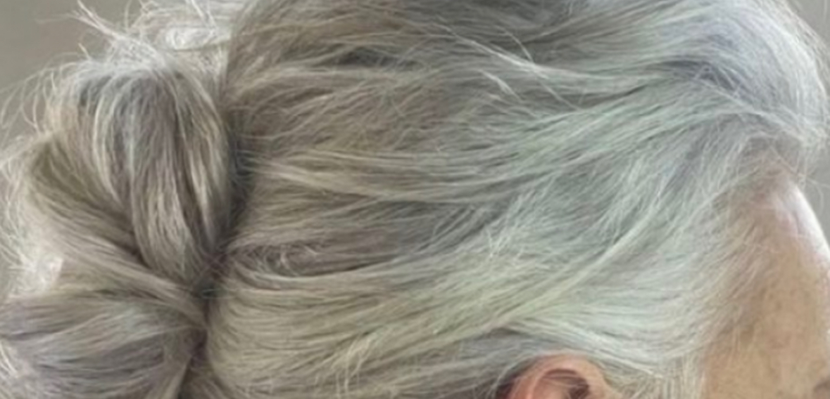 Stresi shkakton thinja, e vërtet apo mit? 