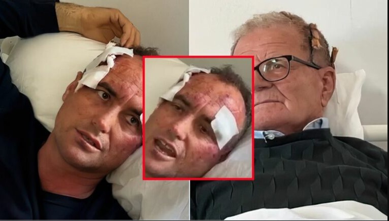 “Do ta shikosh kush jam unë”- U dhunua bashkë me babain pasi komplimentoi motrën e një polici, 46-vjeçari zbulon mesazhin kërcënues