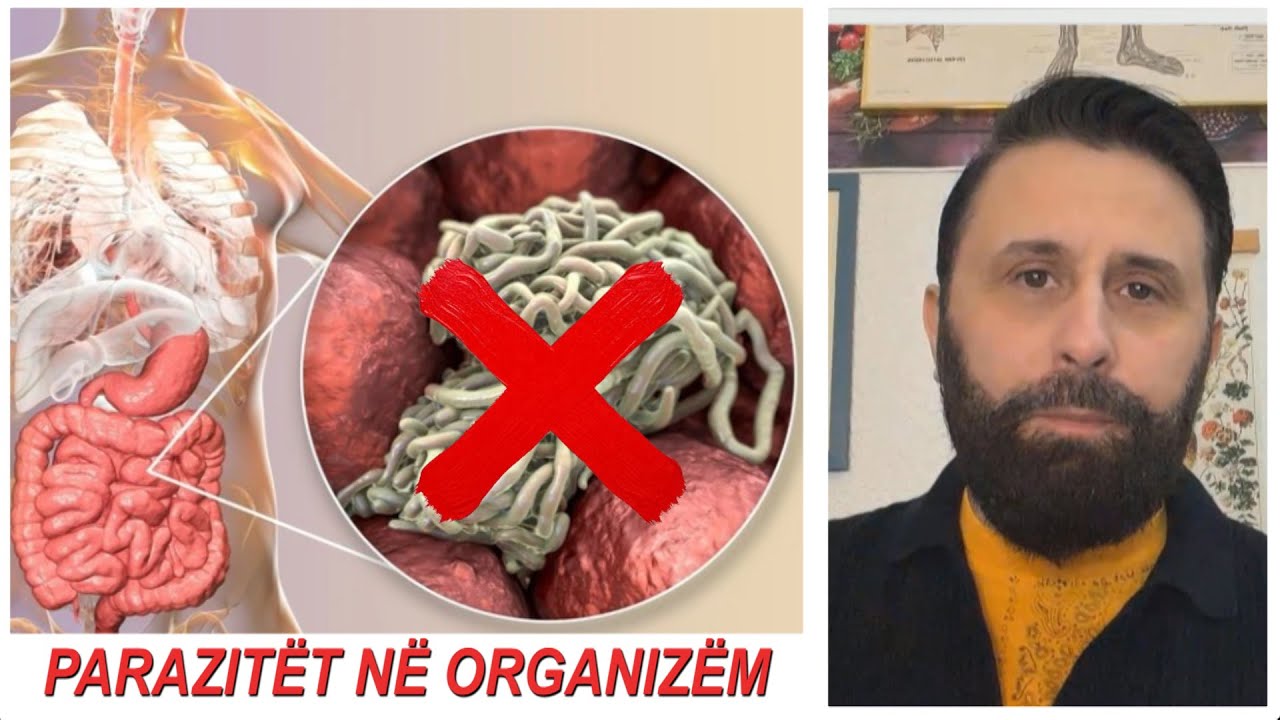 PARAZITËT po na vrasin! Këshilla nga nutricionisti Altin Joka: Si t’i zhdukim nga trupi