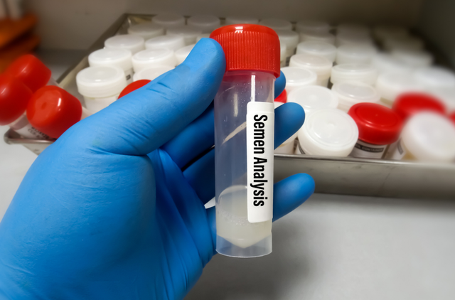 Shkaku më i zakonshëm i infertilitetit mashkullor dhe si mund të trajtohet