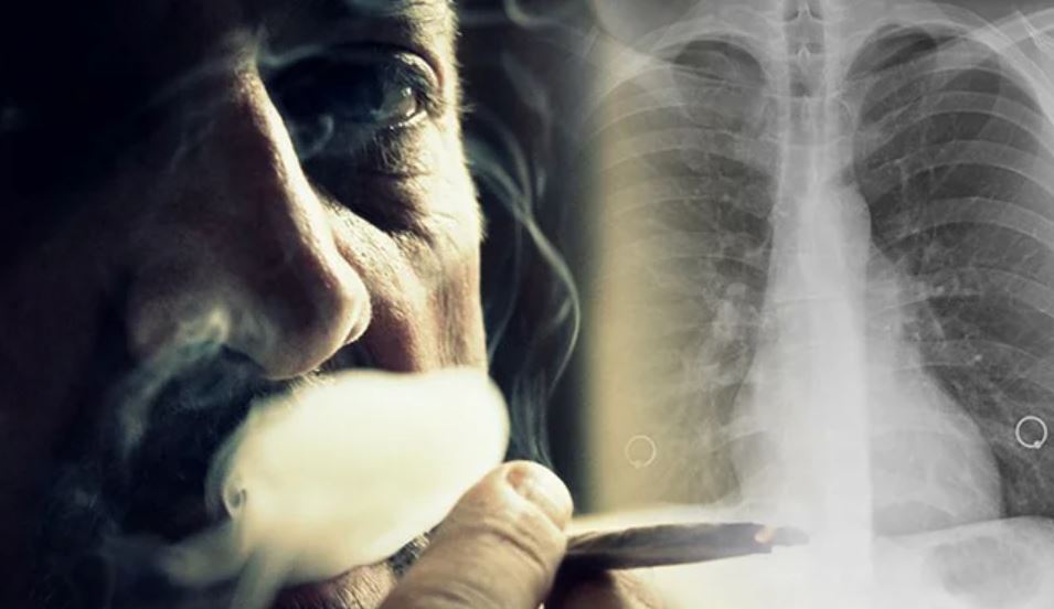 Rrezik nga ajri! Paralajmërojnë shkencëtarët: Ja çfarë u ndodh mushkërive tuaja kur thithni tymin nga cigaret elektronike të të tjerëve