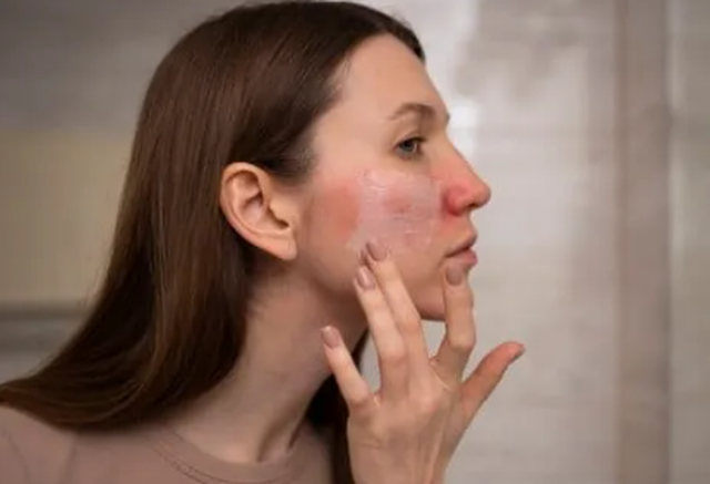 Nga njollat e përhershme te dëmtimet e organeve/ Rreziqet e fshehura në kremrat për zbardhjen e lëkurës