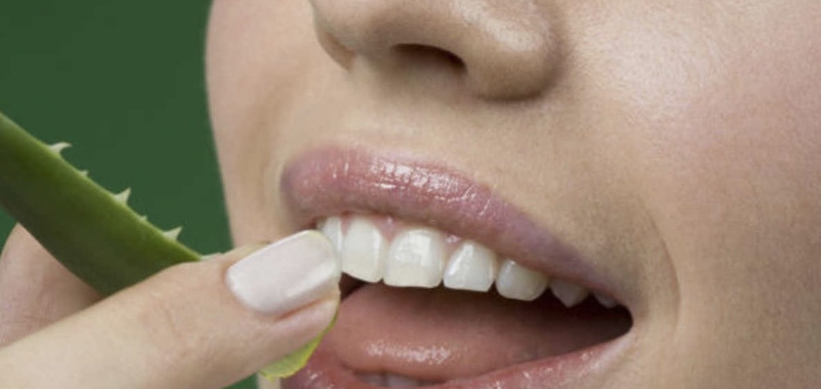 Keni probleme me shëndetin e dhëmbëve? Mësoni si ta kuroni me aloe vera 