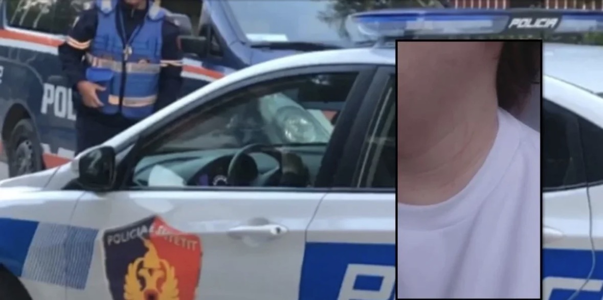 E rëndë në Vlorë, mësuesja dhunohet në mes të ditës, zbardhet dëshmia tronditëse 