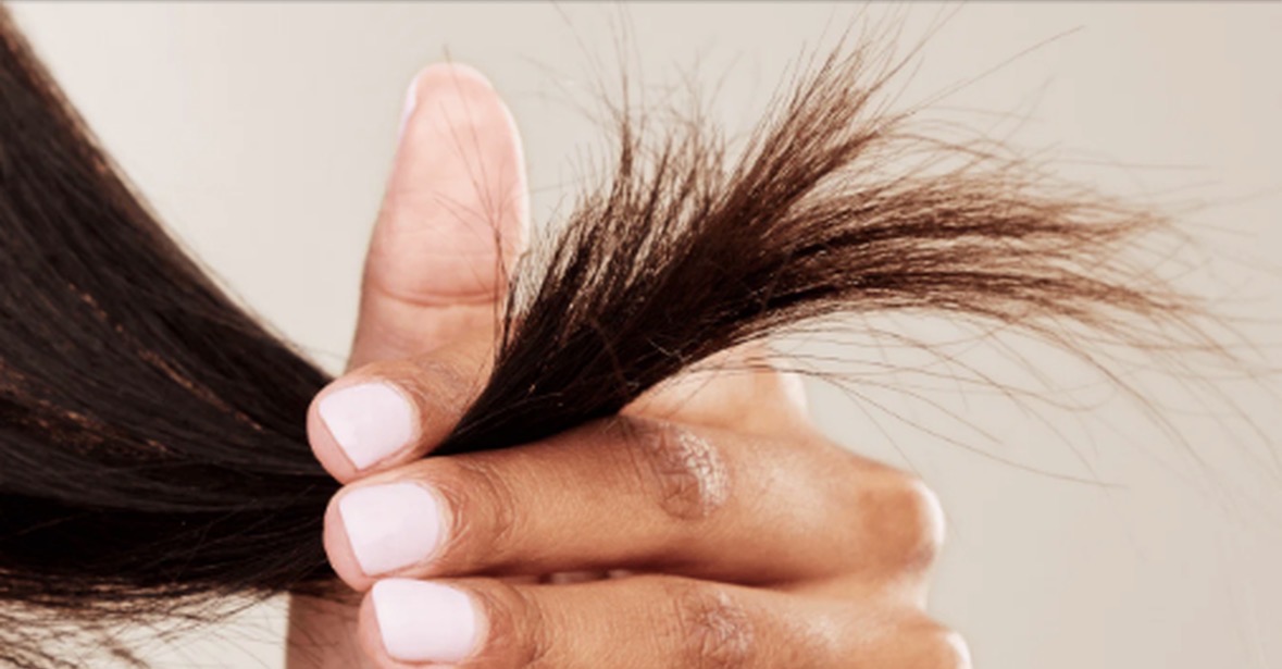 Flokë të djegur dhe maja dyshe? Zgjidhjet natyrale në shtëpi që po zëvendësojnë produktet me kimikate 