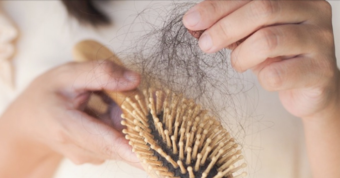 Rënia e flokëve nuk është rastësi/ Ja si lidhet me gjëndrat mbiveshkore dhe hormonet e stresit