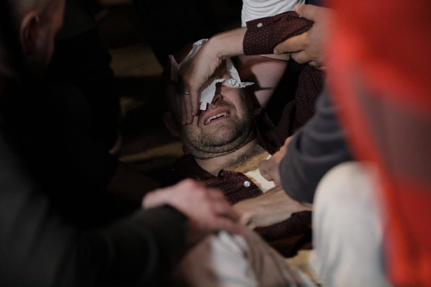 Protesta e opozitës, Gazment Bardhi: Sulm çnjerëzor nga Policia, Edi Rama ka humbur qetësinë! Po e ndjen fundin