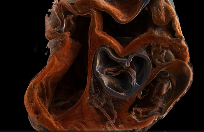 Skanimi i plotë i trupit në 3D, do të realizohet brenda vitit 2027