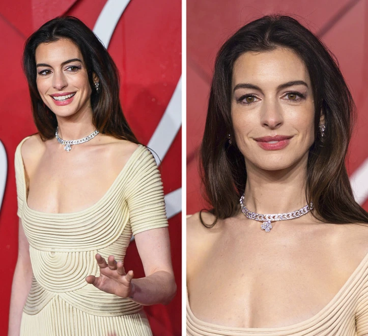 Anne Hathaway i përgjigjet thashethemeve për ndërhyrje estetike: Nuk kam bërë lifting
