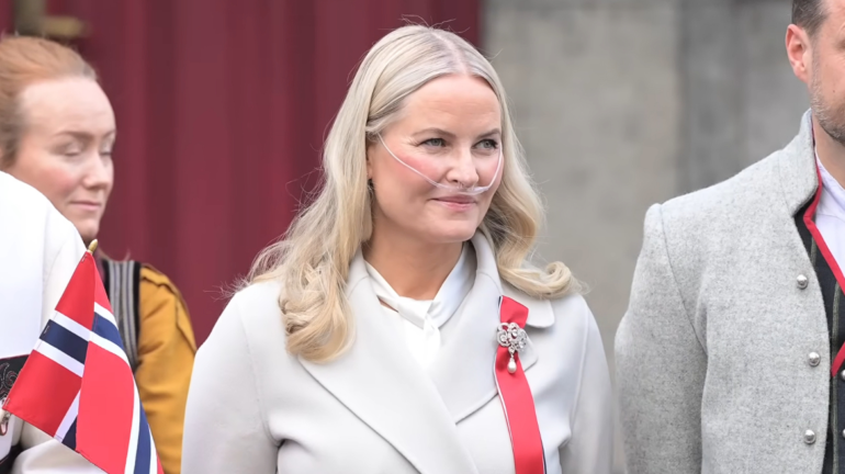 Princesha e Norvegjisë, Mette-Marit i nënshtrohet transplantit të mushkërive, ja si është gjendja shëndetësore