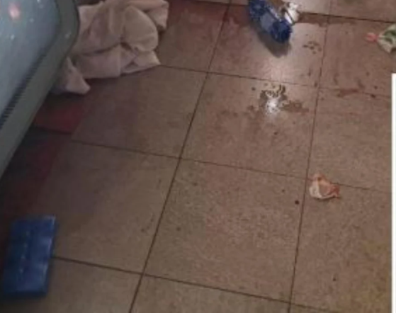 “”Ti je grua, unë jam burrë dhe mysliman”/ Algjeriani sulmon rëndë me thikë 23-vjeçaren në metronë e Milanos