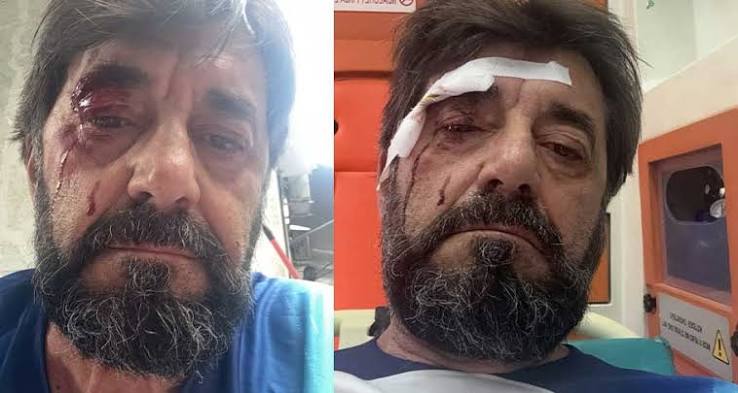 Dhunimi i Ilir Demaliajt, policia: Është shpallur në kërkim autori i dyshuar