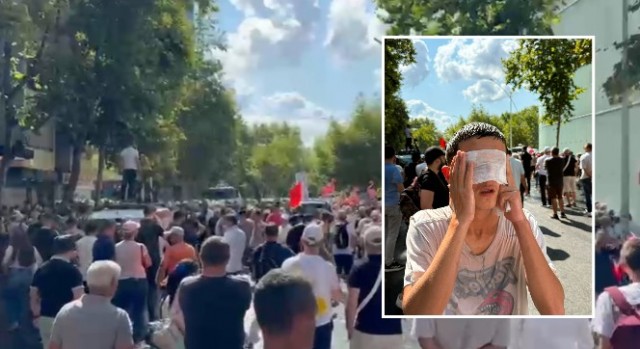 Ujë me ngjyrë blu, gaz lotsjellës dhe piper ndaj protestuesve, disa qytetarë dërgohen me ambulancë