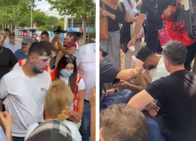 Policia i hodhi spraj në fytyrë, protestuesi niset me autoambulancë drejt spitalit