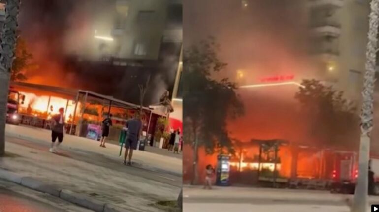 Pësoi djegie të rënda në trup pas zjarrit te hotel “Brooklyn” në Vlorë, 25-vjeçarja dërgohet për mjekim të specializuar në Turqi